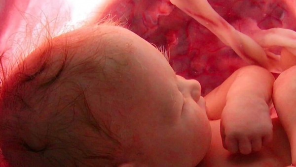 Programa El Don de la Fe (18 de Abril) Tema: La vida es de Dios